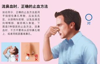 流鼻血怎么能快速止血，鼻出血的正确止血方法